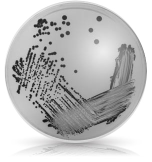 Hot Tub Diseased Petri Dish